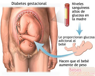 Sintomas De Vih En Mujeres Embarazadas